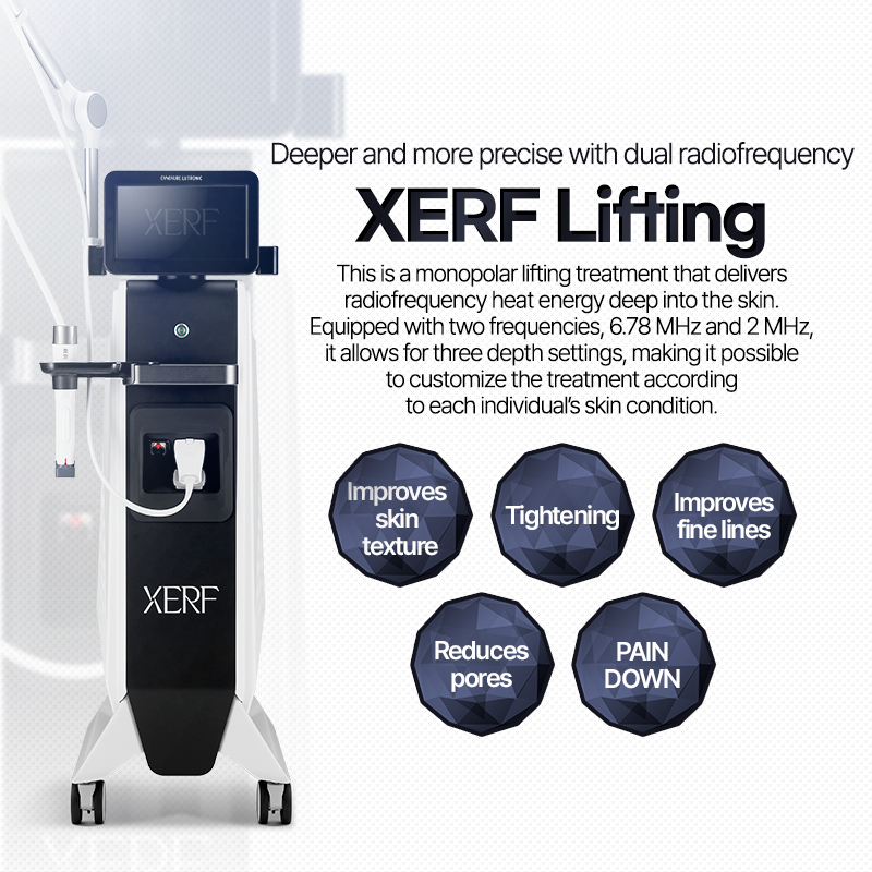 Xerf Lifting - Nampo