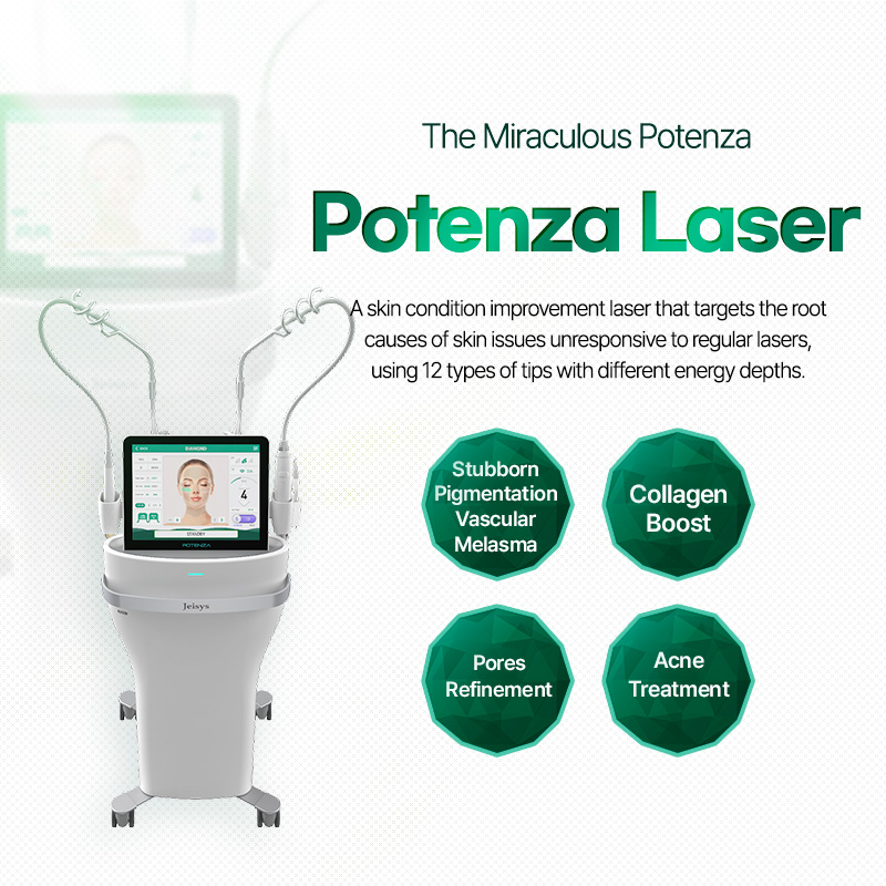 Potenza Laser - Nampo