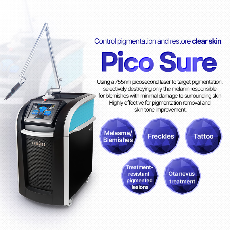Picosure - Nampo