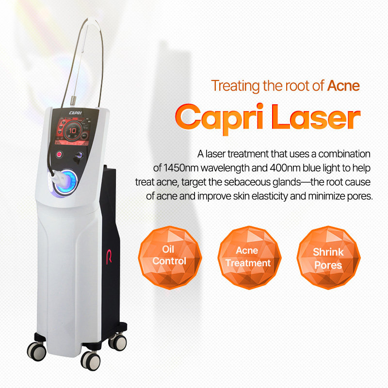 Capri Laser - Nampo